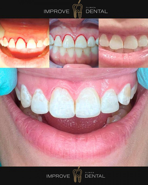 Slider image (6) Improve Dental